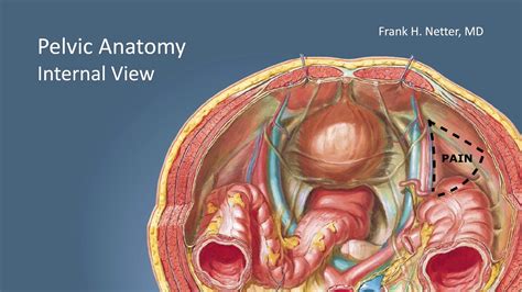 inguinal hernia repair surgery anatomy